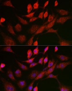 Invitrogen ANT Polyclonal Antibody 100 &mu;L; Unconjugated:Antibodies,
