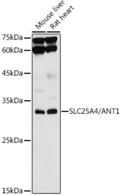 Invitrogen ANT Polyclonal Antibody 100 &mu;L; Unconjugated:Antibodies,