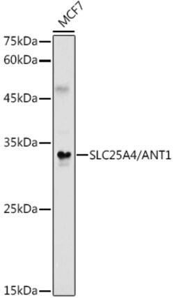 Invitrogen ANT Polyclonal Antibody 100 &mu;L; Unconjugated:Antibodies,