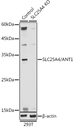 Invitrogen ANT Polyclonal Antibody 100 &mu;L; Unconjugated:Antibodies,