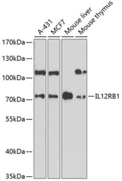Invitrogen IL12RB1 Polyclonal Antibody 100 &mu;L; Unconjugated:Antibodies,