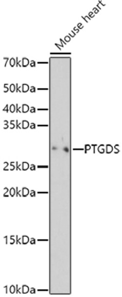 Invitrogen PTGDS Polyclonal Antibody 100 &mu;L; Unconjugated:Antibodies,