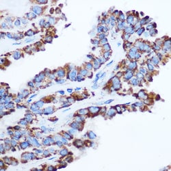 Invitrogen PDHA1 Polyclonal Antibody 100 &mu;L; Unconjugated:Antibodies,