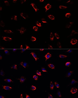 Invitrogen IL-11 Polyclonal Antibody 100 &mu;L; Unconjugated:Antibodies,