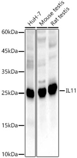 Invitrogen IL-11 Polyclonal Antibody 100 &mu;L; Unconjugated:Antibodies,