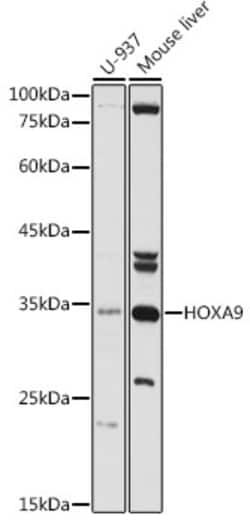 Invitrogen HOXA9 Polyclonal Antibody 100 &mu;L; Unconjugated:Antibodies,