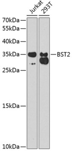 Invitrogen BST-2 Polyclonal Antibody 100 &mu;L; Unconjugated:Antibodies,