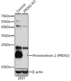 Invitrogen PRDX2 Polyclonal Antibody 100 &mu;L; Unconjugated:Antibodies,