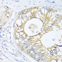 GNAI3 Polyclonal Antibody, Invitrogen 100 &mu;L; Unconjugated:Antibodies,