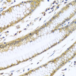 GNAI3 Polyclonal Antibody, Invitrogen 100 &mu;L; Unconjugated:Antibodies,