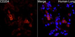 Invitrogen CD204 Polyclonal Antibody 100 &mu;L; Unconjugated:Antibodies,