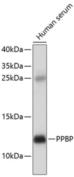 Invitrogen PPBP Polyclonal Antibody 100 &mu;L | Buy Online | Invitrogen&trade; | Fisher Scientific