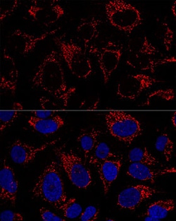 Invitrogen TFAM Polyclonal Antibody 100 &mu;L; Unconjugated:Antibodies,