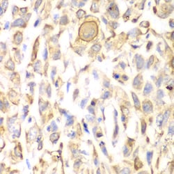 Invitrogen CD151 Polyclonal Antibody 100 &mu;L; Unconjugated:Antibodies,