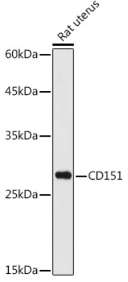 Invitrogen CD151 Polyclonal Antibody 100 &mu;L; Unconjugated:Antibodies,