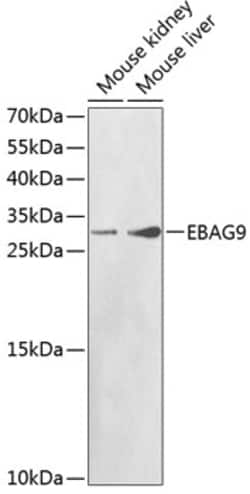 Invitrogen EBAG9 Polyclonal Antibody 100 &mu;L; Unconjugated:Antibodies,