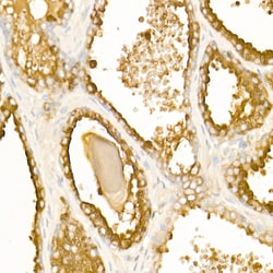 Invitrogen Prostate Specific Acid Phosphatase Polyclonal Antibody 100 &mu;L;