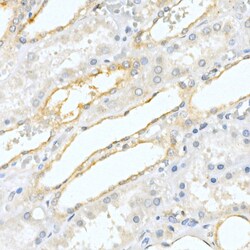 Invitrogen Prostate Specific Acid Phosphatase Polyclonal Antibody 100 &mu;L;