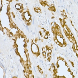 Invitrogen Prostate Specific Acid Phosphatase Polyclonal Antibody 100 &mu;L;