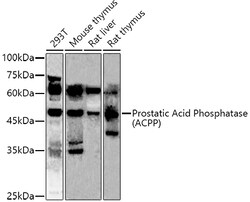 Invitrogen Prostate Specific Acid Phosphatase Polyclonal Antibody 100 &mu;L;