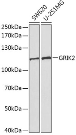 Invitrogen GluR6 Polyclonal Antibody 100 &mu;L; Unconjugated:Antibodies,