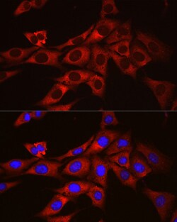 Invitrogen ODC1 Polyclonal Antibody 100 &mu;L; Unconjugated:Antibodies,