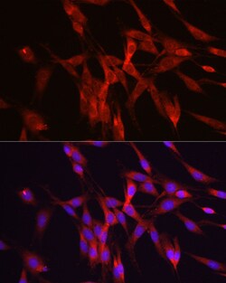 Invitrogen ODC1 Polyclonal Antibody 100 &mu;L; Unconjugated:Antibodies,