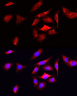 Invitrogen ODC1 Polyclonal Antibody 100 &mu;L; Unconjugated:Antibodies,