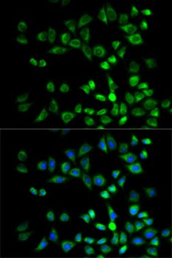 Invitrogen PSMD10 Polyclonal Antibody 100 &mu;L | Buy Online | Invitrogen&trade; | Fisher Scientific
