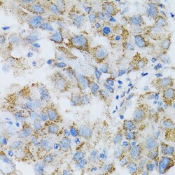 Invitrogen PSMD10 Polyclonal Antibody 100 &mu;L | Buy Online | Invitrogen&trade; | Fisher Scientific