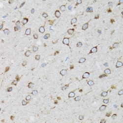 Invitrogen UBE2D1 Polyclonal Antibody 100 &mu;L; Unconjugated:Antibodies,