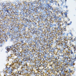 Invitrogen UBE2D1 Polyclonal Antibody 100 &mu;L; Unconjugated:Antibodies,