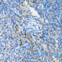Invitrogen UBE2D1 Polyclonal Antibody 100 &mu;L; Unconjugated:Antibodies,