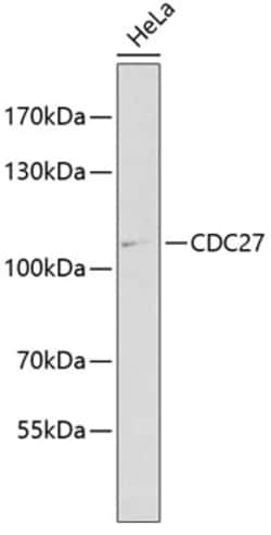 Invitrogen Cdc27 Polyclonal Antibody 100 &mu;L; Unconjugated:Antibodies,