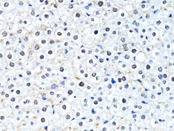 Invitrogen HIST2H2BE Polyclonal Antibody 100 &mu;L; Unconjugated:Antibodies,