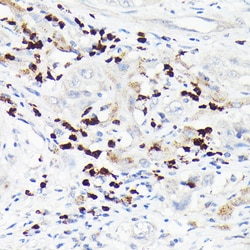 Invitrogen MMP8 Polyclonal Antibody 100 &mu;L; Unconjugated:Antibodies,