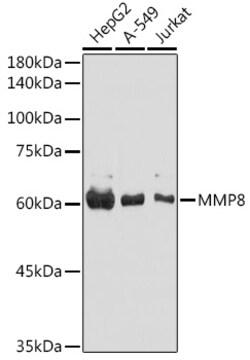 Invitrogen MMP8 Polyclonal Antibody 100 &mu;L; Unconjugated:Antibodies,