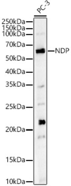 Invitrogen NDP Polyclonal Antibody 100 &mu;L | Buy Online | Invitrogen&trade; | Fisher Scientific