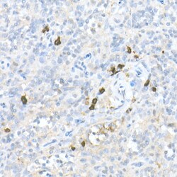Invitrogen MDC Polyclonal Antibody 100 &mu;L; Unconjugated:Antibodies,
