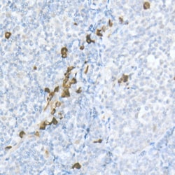 Invitrogen MDC Polyclonal Antibody 100 &mu;L; Unconjugated:Antibodies,