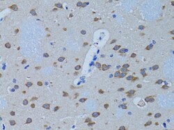 PLCB1 Polyclonal Antibody:Antibodies, Polyclonal