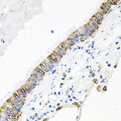 Invitrogen ACVR2A Polyclonal Antibody 100 &mu;L; Unconjugated:Antibodies,