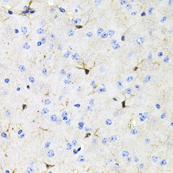 Invitrogen ACVR2A Polyclonal Antibody 100 &mu;L; Unconjugated:Antibodies,