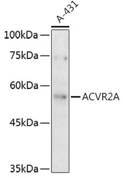 Invitrogen ACVR2A Polyclonal Antibody 100 &mu;L; Unconjugated:Antibodies,