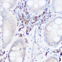 Invitrogen Thromboxane synthase Polyclonal Antibody 100 &mu;L; Unconjugated:Antibodies,