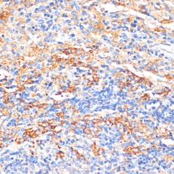 Invitrogen Serum Amyloid P Polyclonal Antibody 100 &mu;L; Unconjugated:Antibodies,