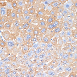 Invitrogen Serum Amyloid P Polyclonal Antibody 100 &mu;L; Unconjugated:Antibodies,