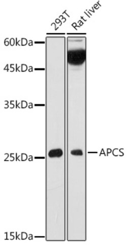 Invitrogen Serum Amyloid P Polyclonal Antibody 100 &mu;L; Unconjugated:Antibodies,
