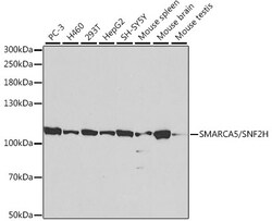 Invitrogen SMARCA5 Polyclonal Antibody 100 &mu;L; Unconjugated:Antibodies,