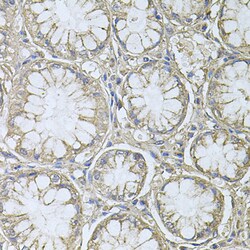 Invitrogen PRL3 Polyclonal Antibody 100 &mu;L; Unconjugated:Antibodies,